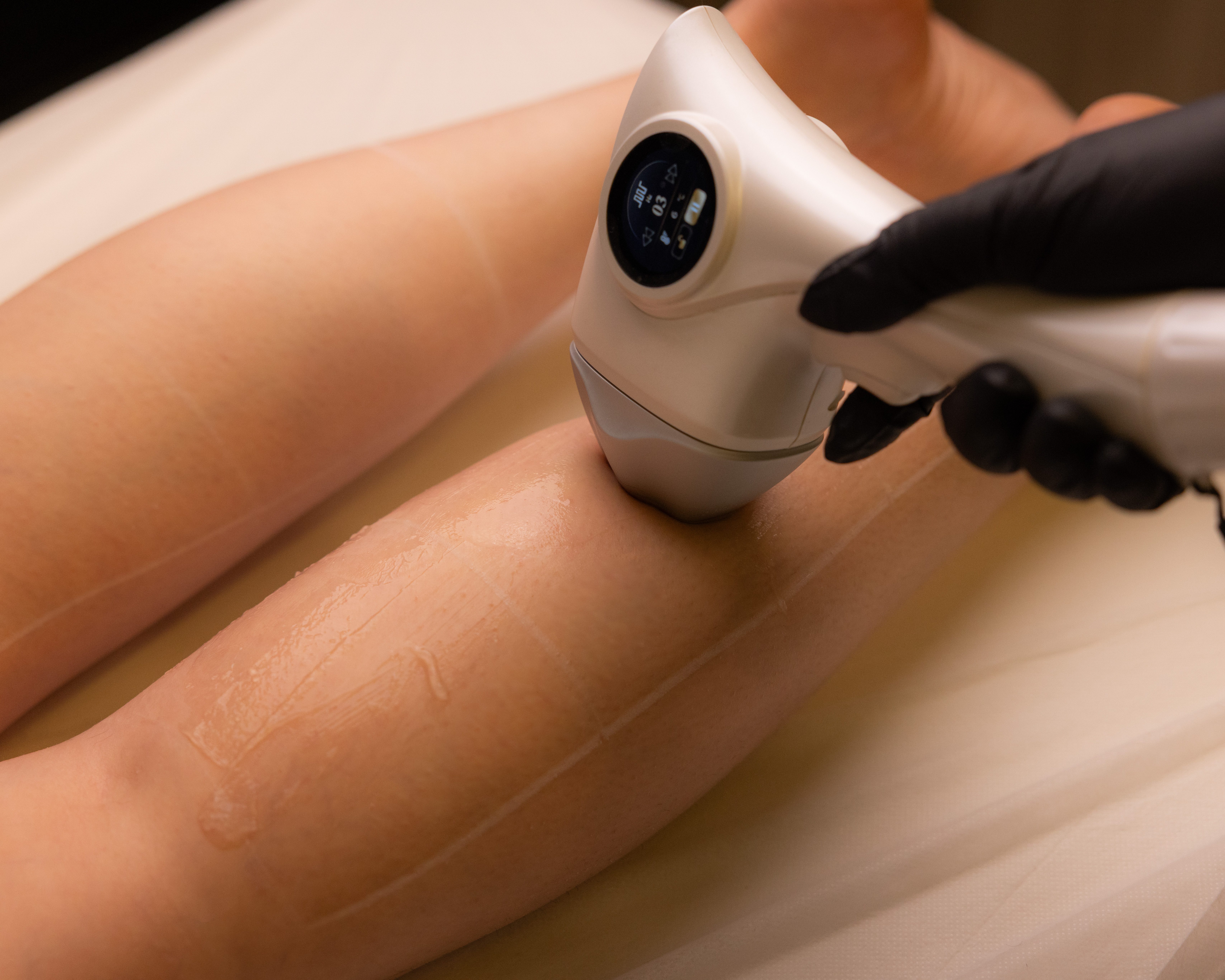 Hair Removal