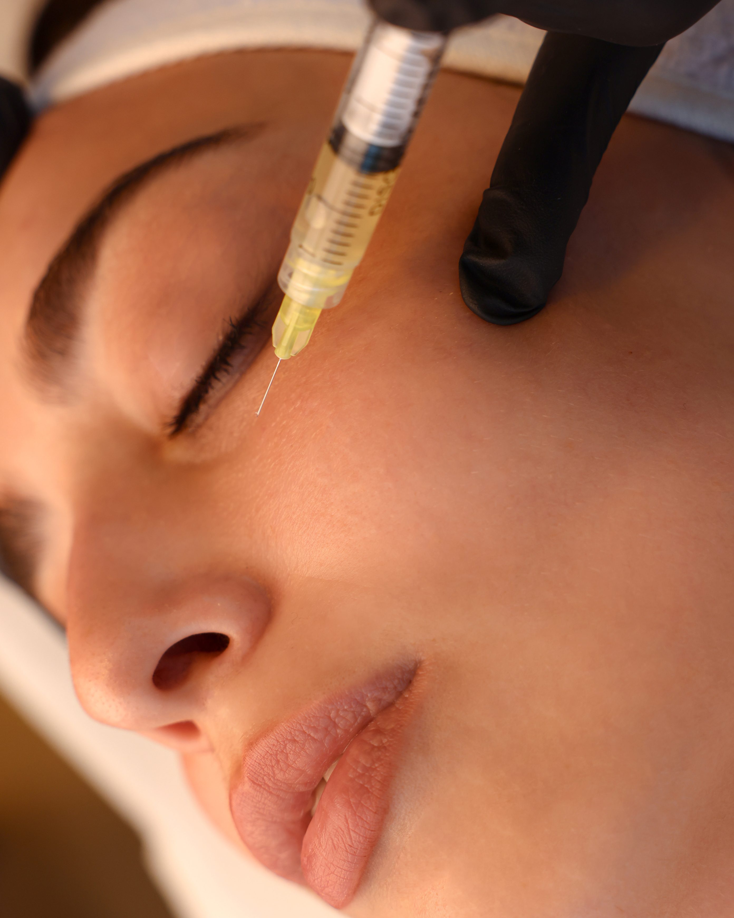 Skin Boosters  